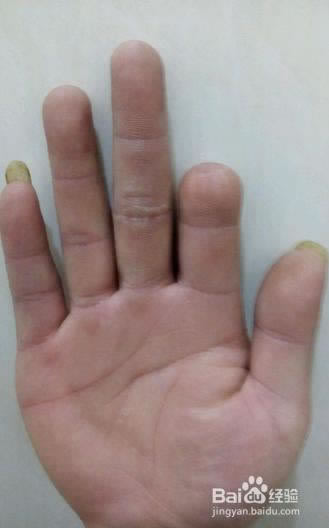 注单异常提不了款怎么办教你应对策略!